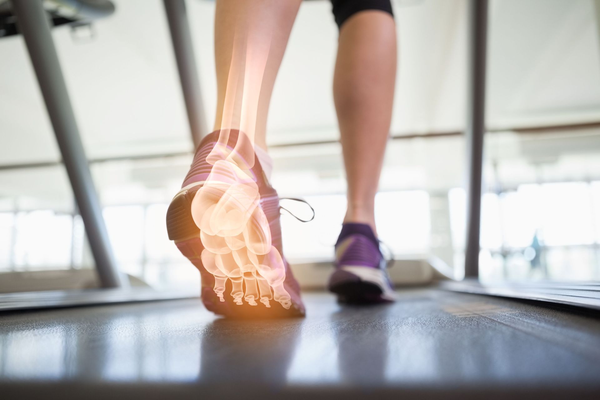 Person walking on treadmill, foot bones highlighted. Purple and gray sneakers.