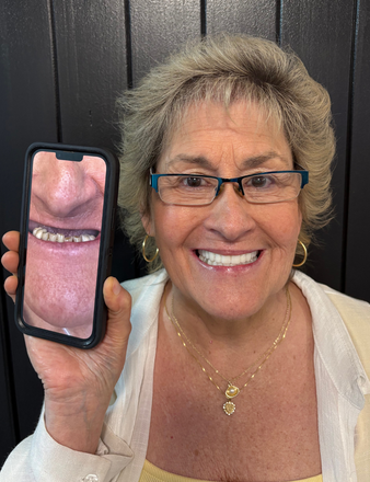 Woman holding phone with zoomed-in image of teeth. She's smiling, wearing glasses and a necklace, against a black wall.