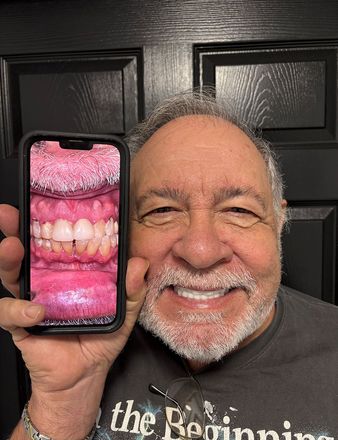 Man holding phone showing teeth, smiling broadly, against a black door.