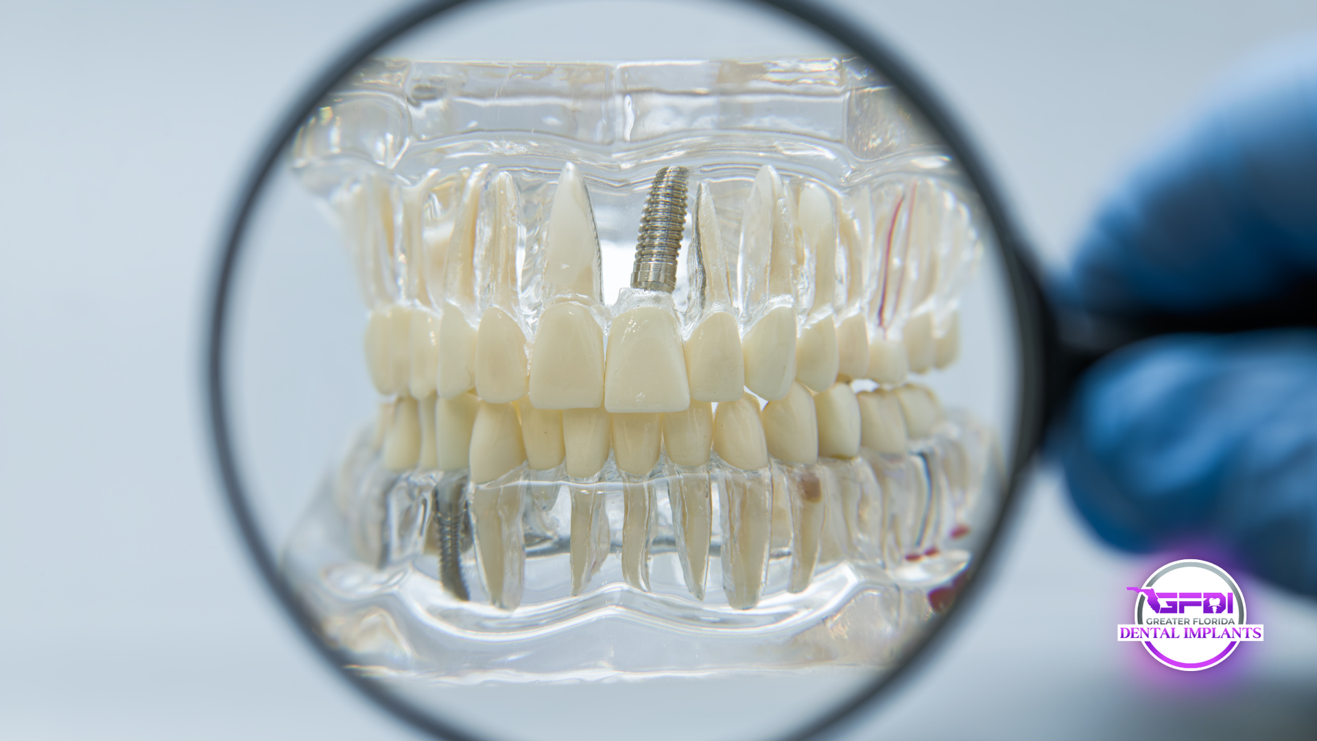 Dentures displayed under a magnifying glass, held by a blue-gloved hand