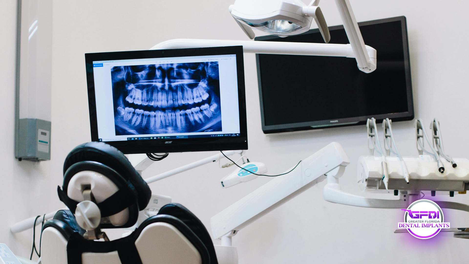 Dental clinic with monitor showing panoramic X-ray, chair, and dental tools in a bright treatment room