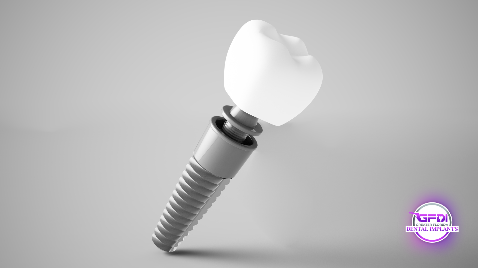 Dental implant with white tooth crown on a light gray background