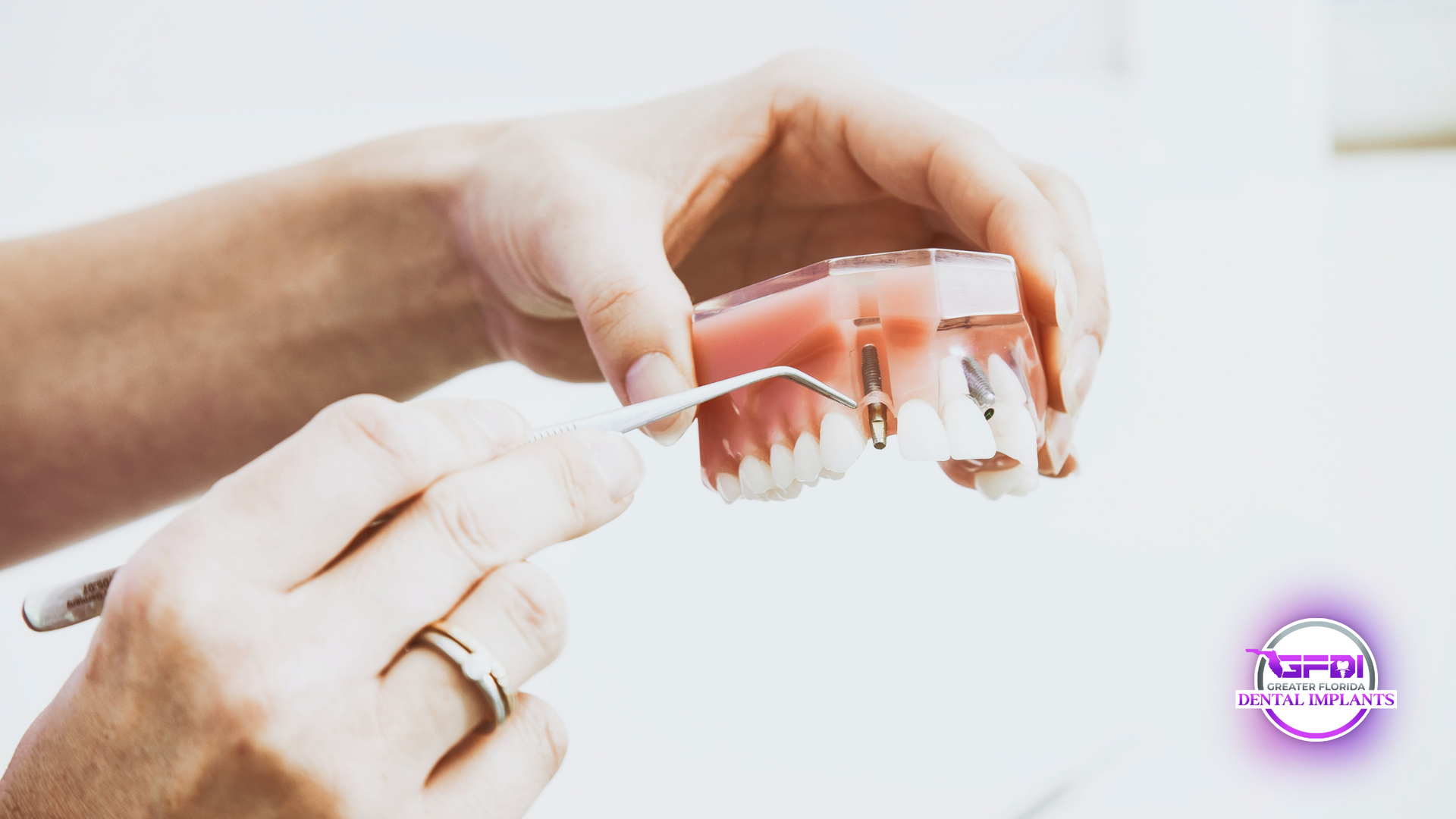 Hands holding a dental model with a probe, demonstrating teeth cleaning.