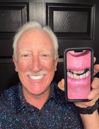 Man holding phone showing teeth, smiling broadly, against a black door.