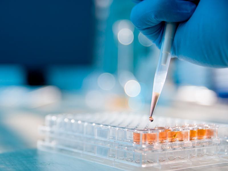 Gloved hand pipetting liquid into a microplate in a laboratory