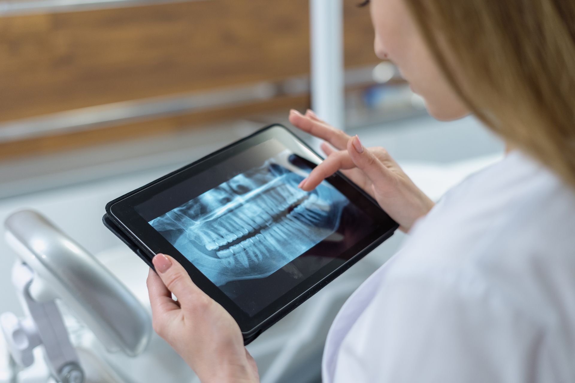 Understanding the Different Types of Dental XRays and Their Uses
