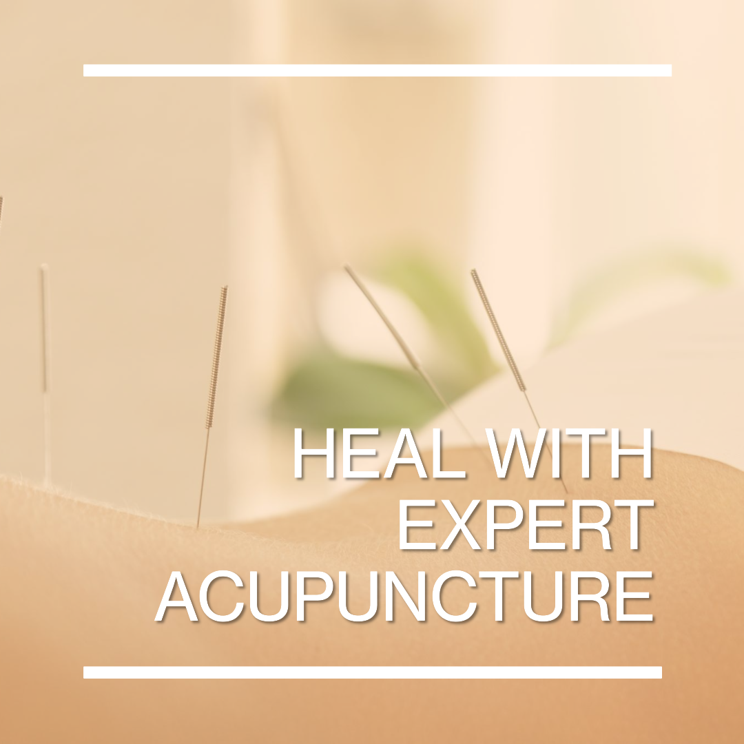 Acupuncture Banner
