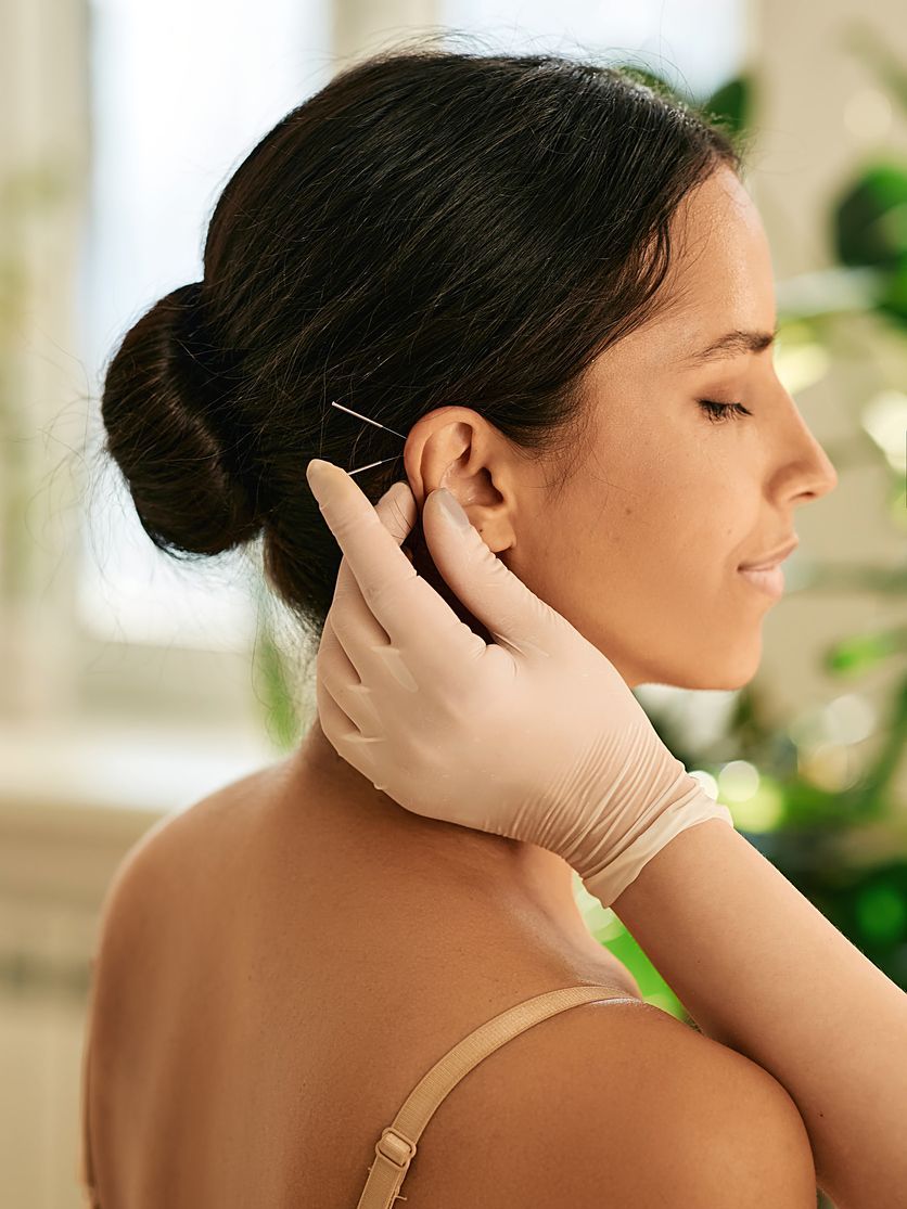 Woman having ear acupuncture Woman having ear acupuncture