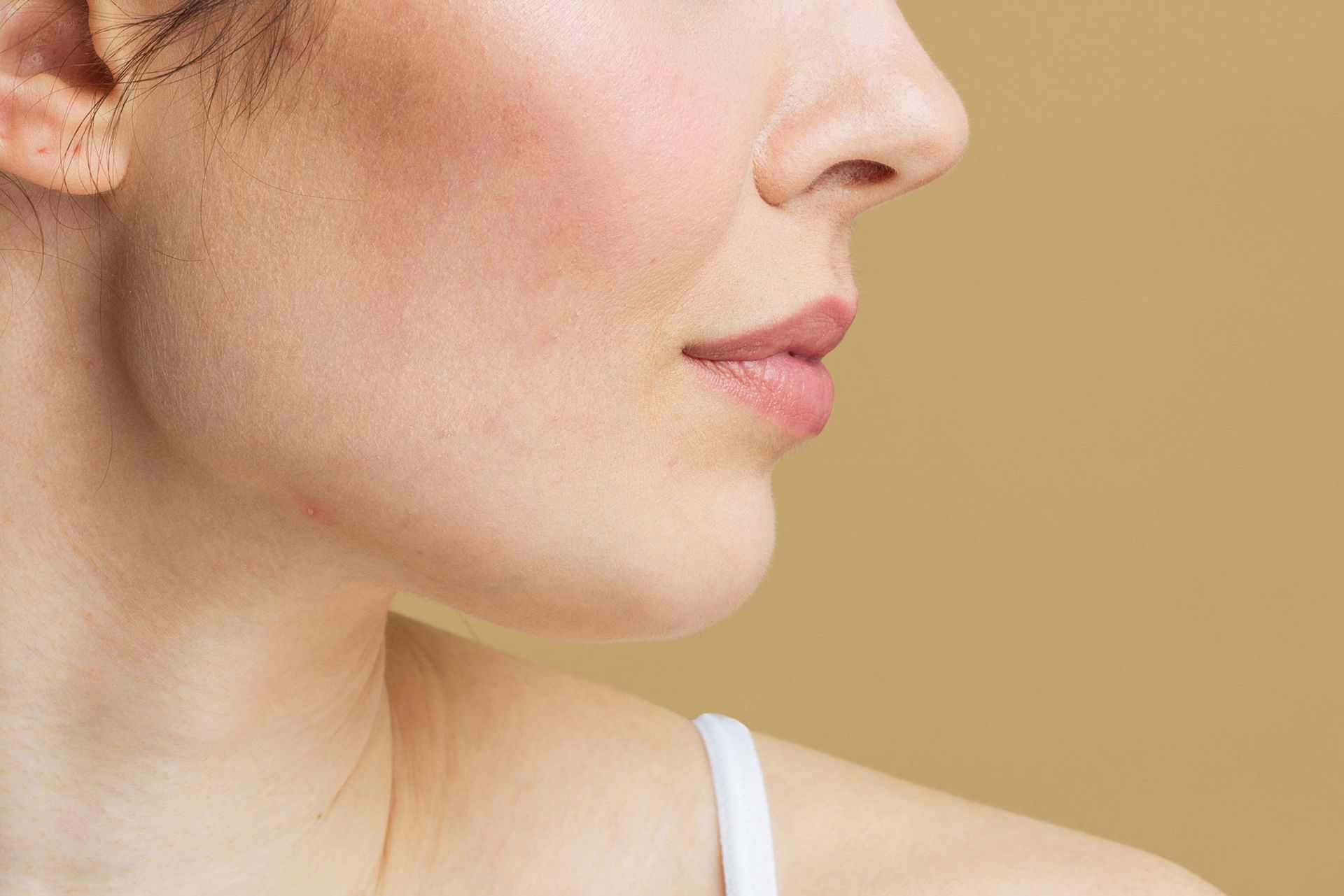 curata dall'acne