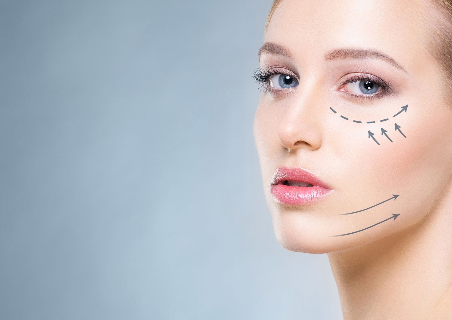 Lifting non chirurgico biostimolante