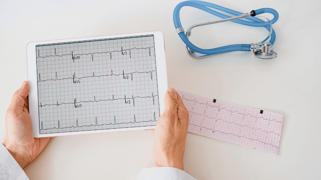 Aritmie cardiache: sintomi, cause, prevenzione e cure spiegate dal cardiologo