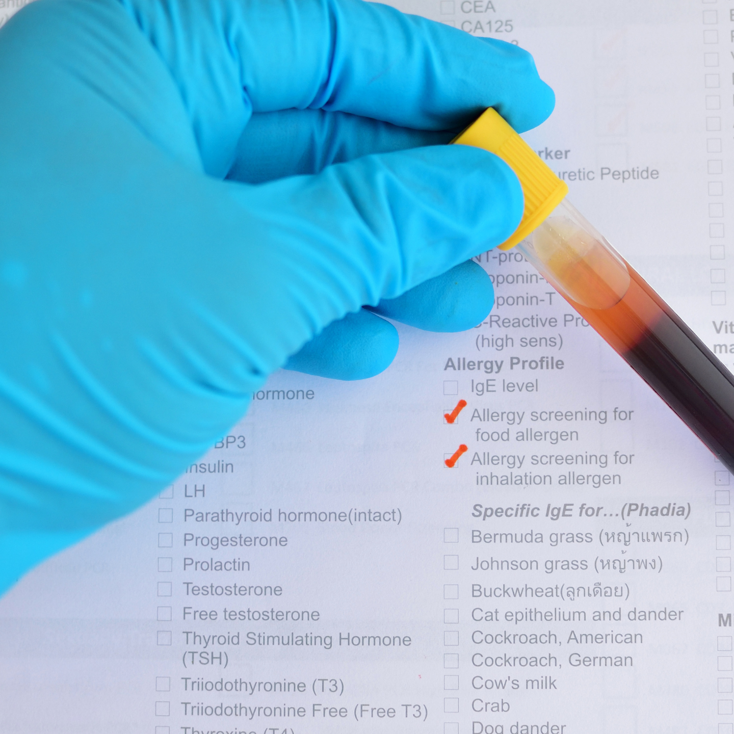 Test Diagnostici per le Allergie Alimentari