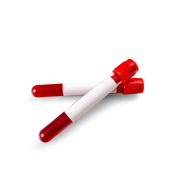 Esami del sangue 