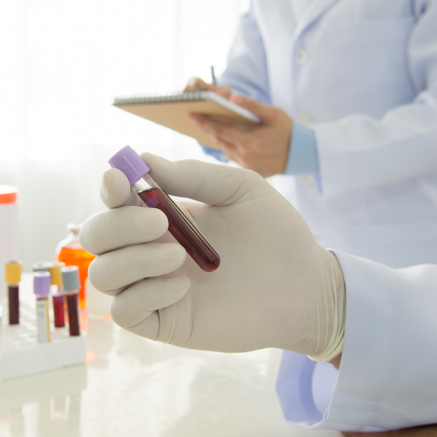 Test Diagnostici per le Intolleranze Alimentari