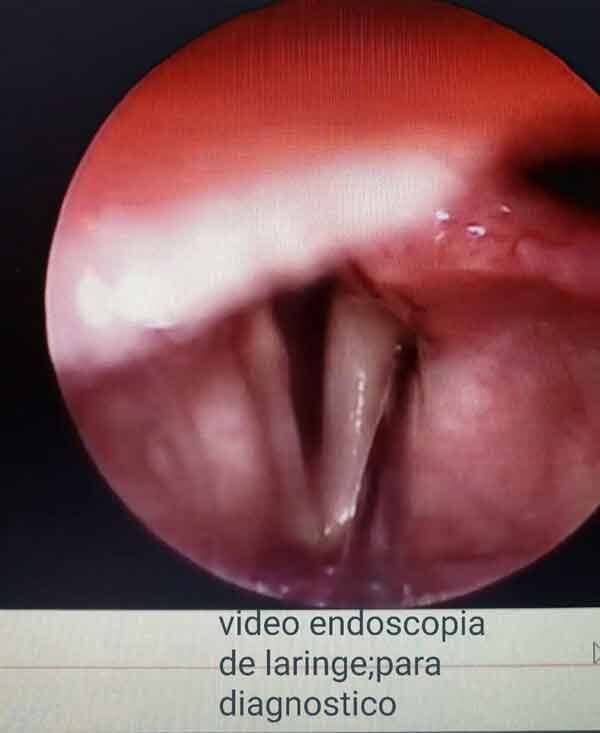 DR. RODRIGO CASTRO MARTÍNEZ - VÍDEO ENDOSCOPIA PARA DIAGNÓSTICO