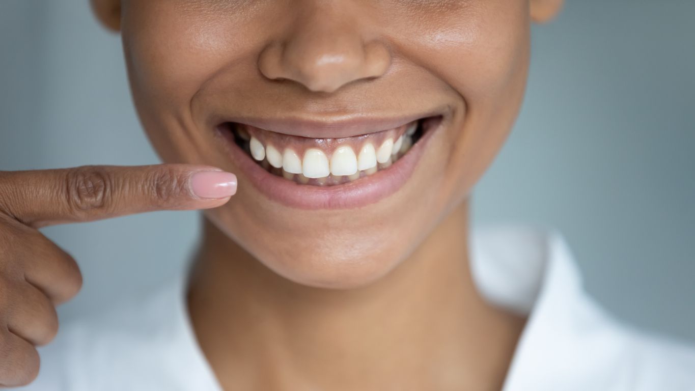 Person pointing to their bright, white teeth with a smile, close-up.
