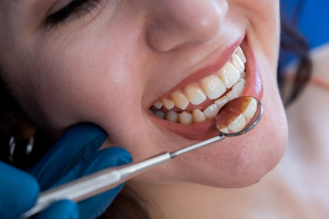A woman is getting her teeth examined by a dentist.