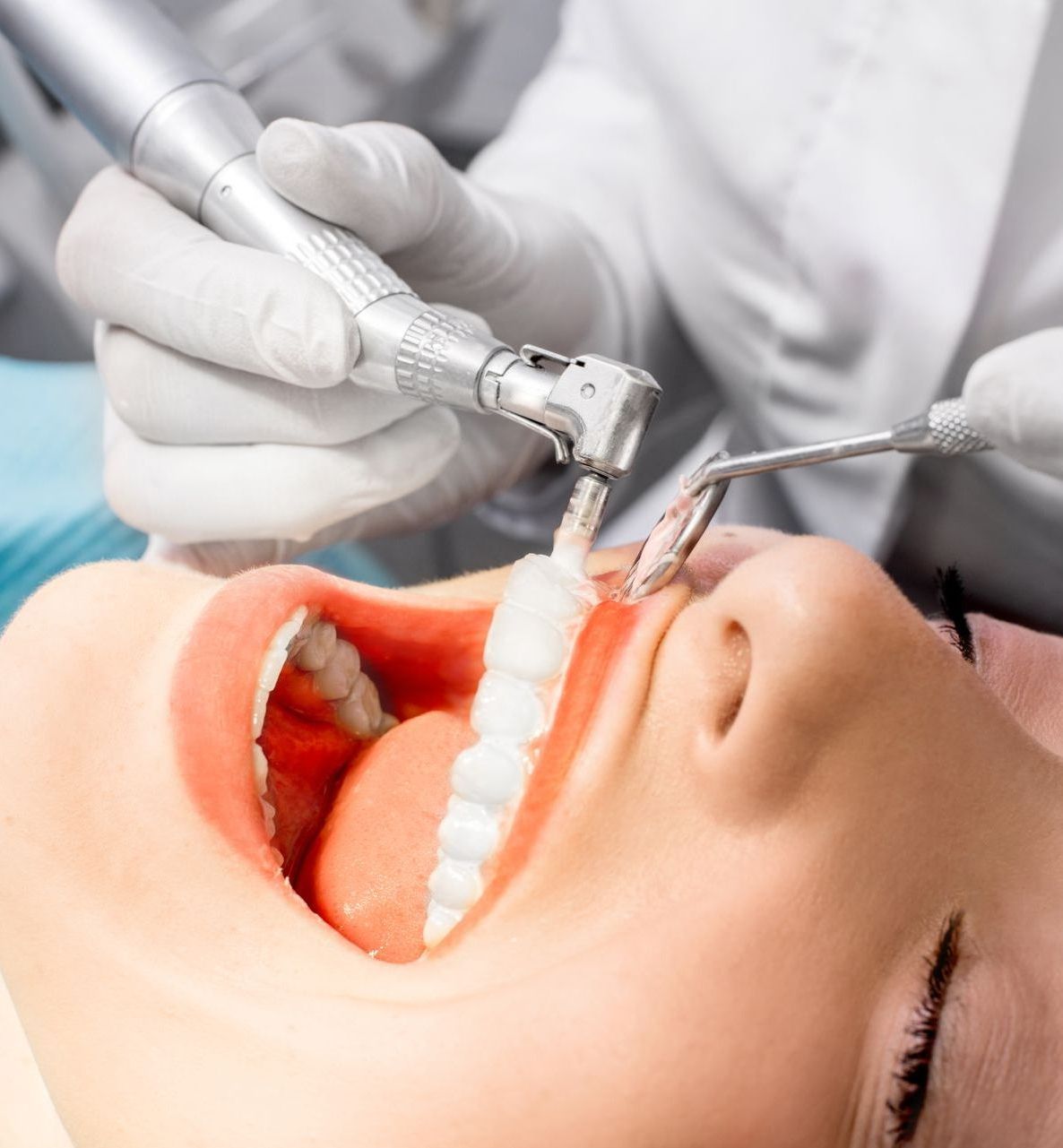 A woman is getting her teeth examined by a dentist.