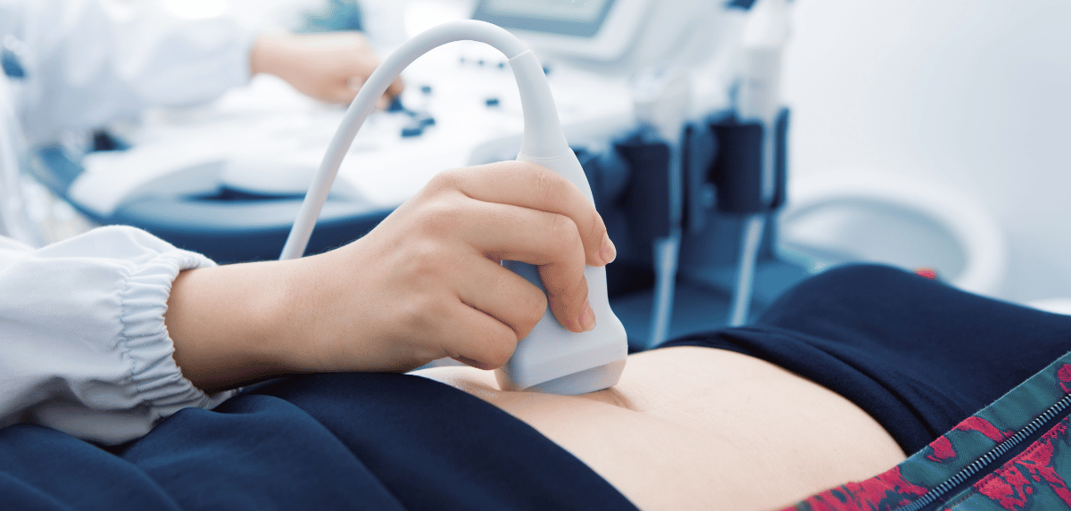A person's stomach being examined with an ultrasound machine. A hand holds the probe over the patient's abdomen.