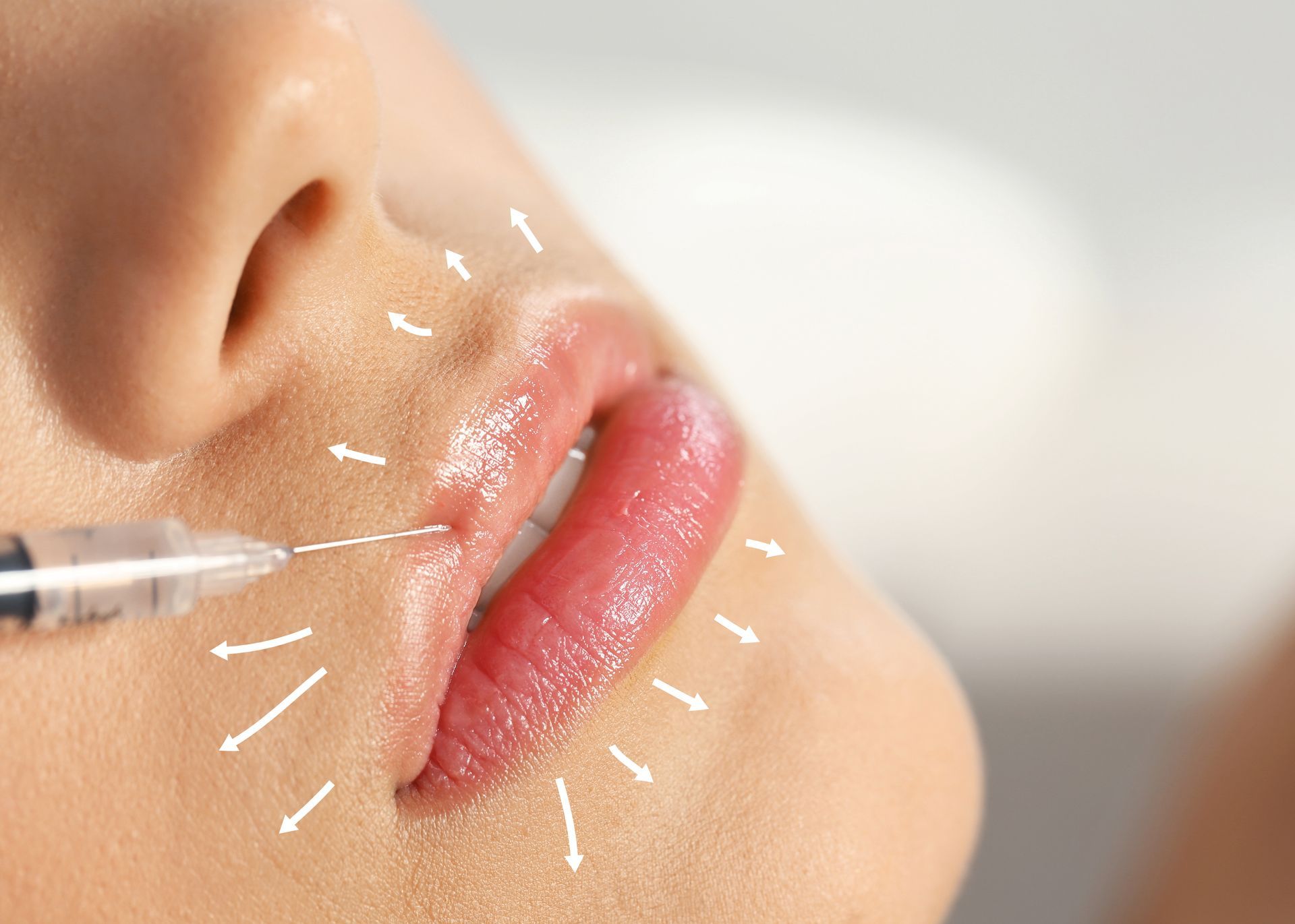 Close-up of lips being injected with a syringe, suggesting a cosmetic lip treatment