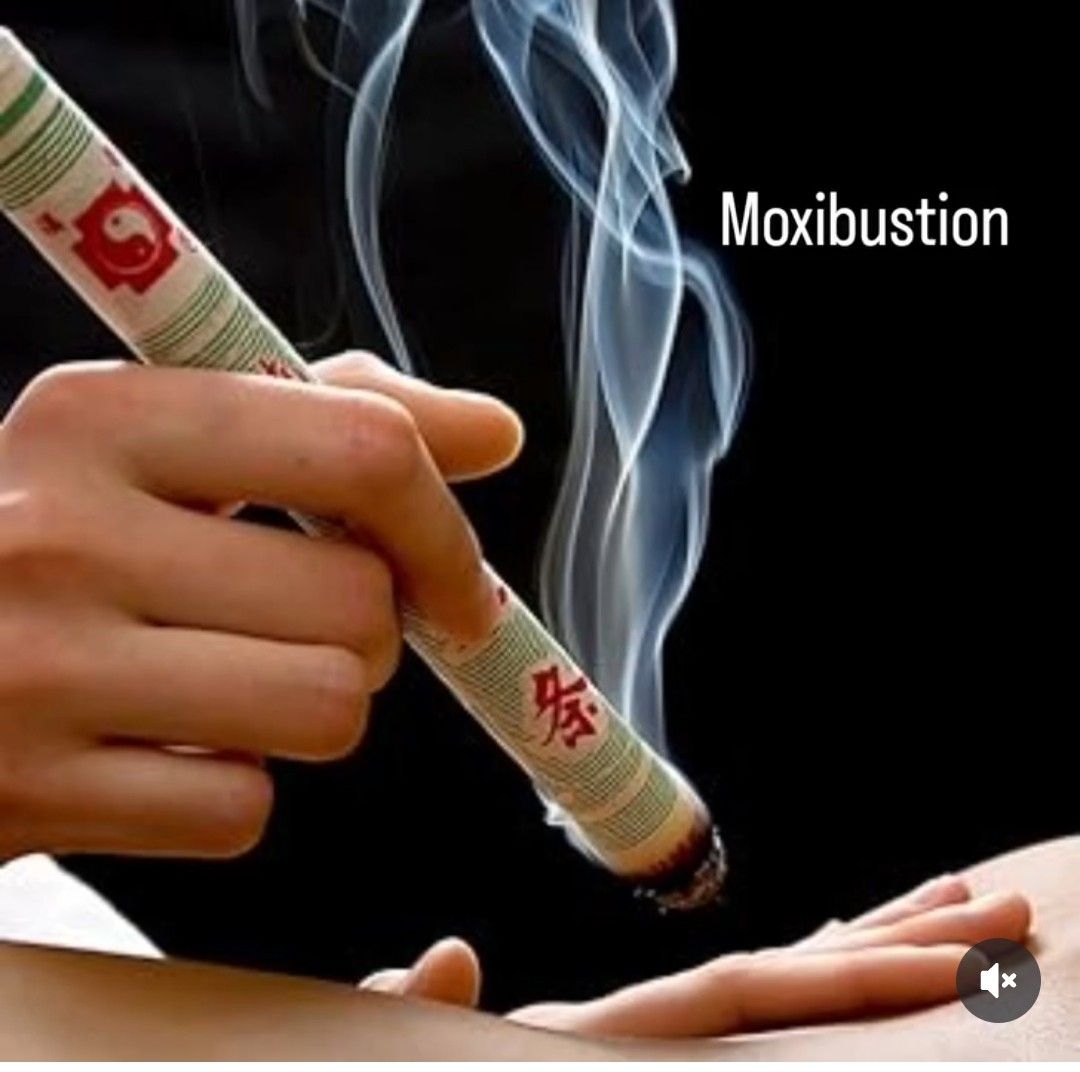 Una mano sostiene un bastón de moxibustión encendido cerca de la piel, con humo elevándose