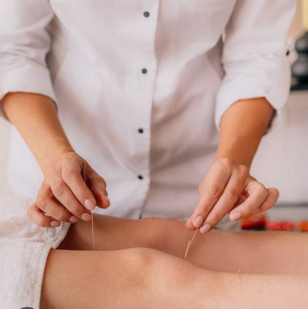 Persona que realiza acupuntura en la espalda de un paciente en un entorno clínico.