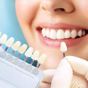 Smile showing dental shade matching with teeth color guide and gloved hand holding a veneer sample
