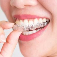 Person biting a clear dental aligner over their teeth