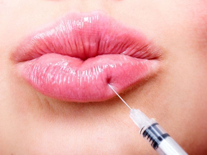 Close-up of glossy pink lips with a syringe needle touching the lower lip