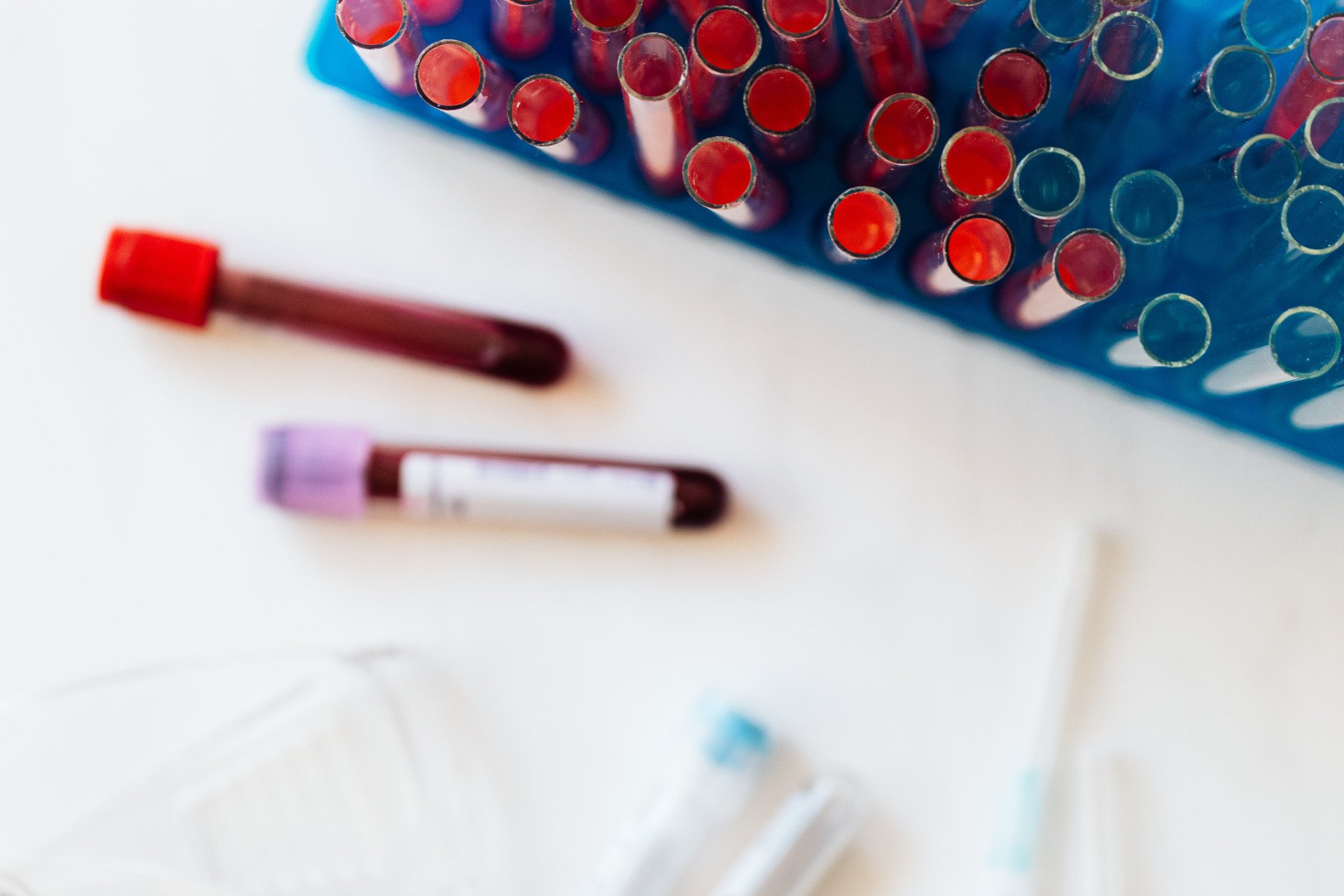 blood in tubes for testing
