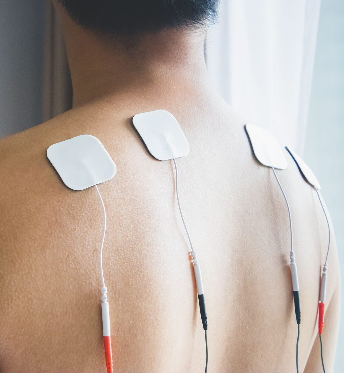 Back view of a person wearing four white electrode pads on the upper back with wires attached
