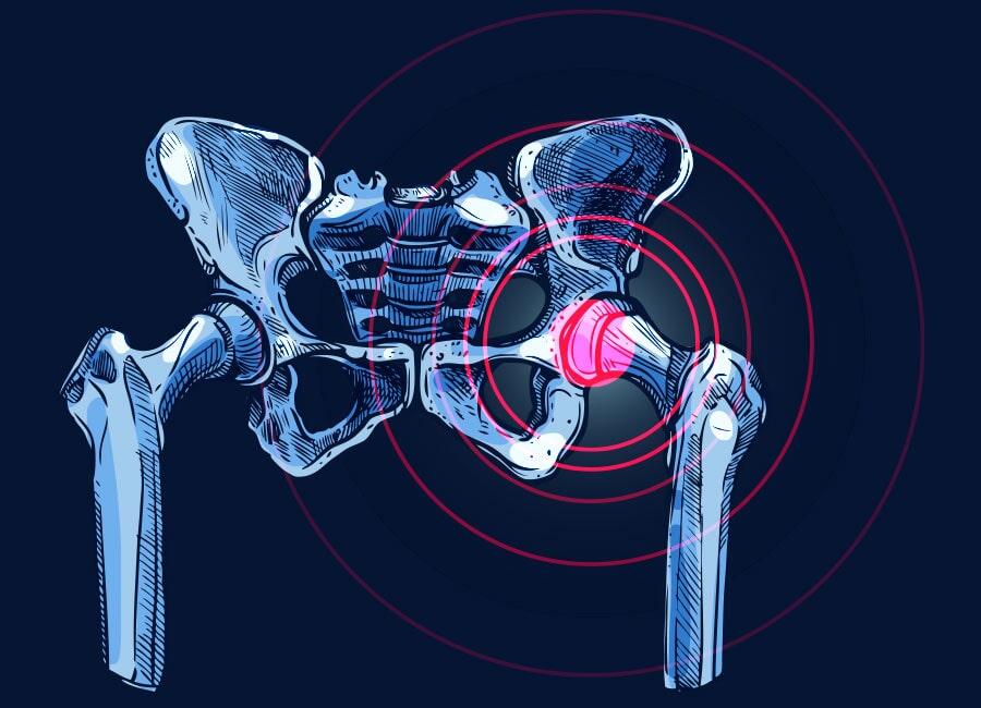 DR. JUAN CARLOS CADENA SOTO - traumatólogo ortopedista