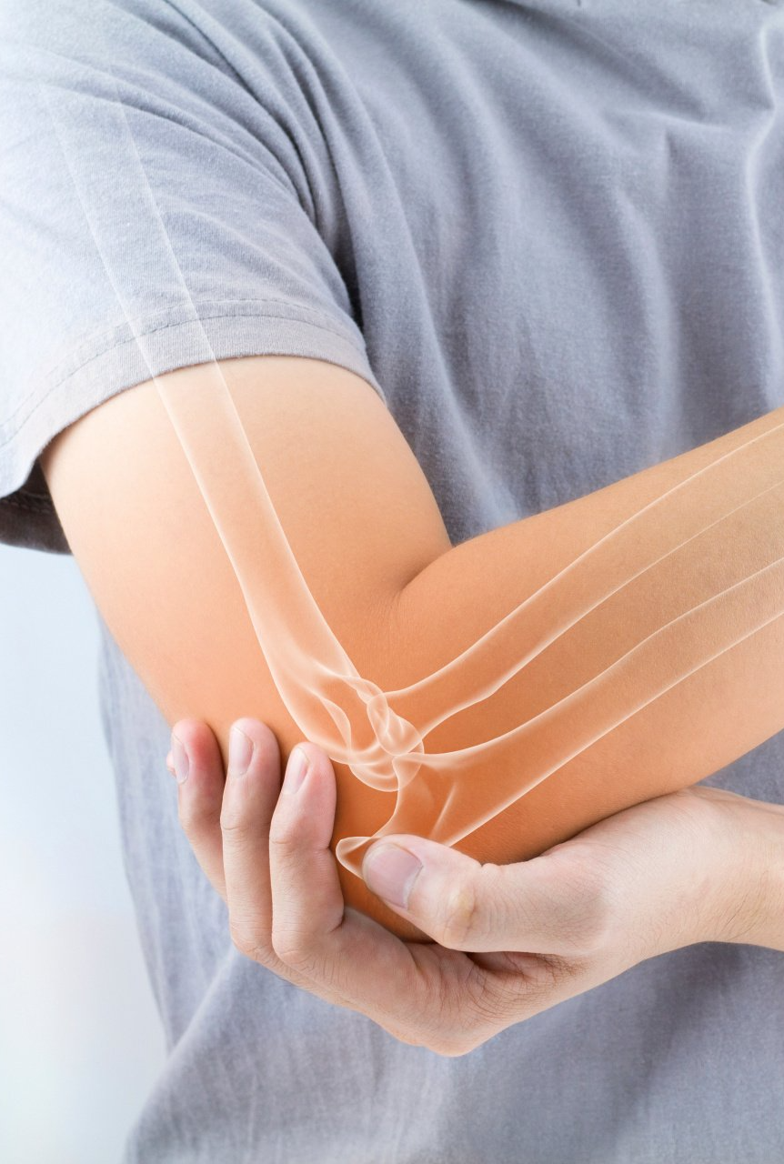 Osteocondrite do Cotovelo Osteocondrite do Cotovelo