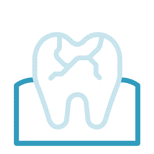 Tooth icon with a cavity and blue outline.
