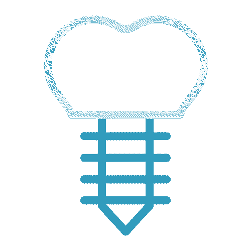 Blue dental implant illustration.