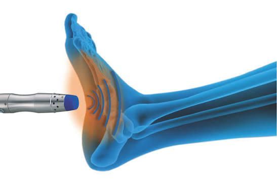 Blue ultrasound device near a forearm, showing sound waves entering the elbow joint