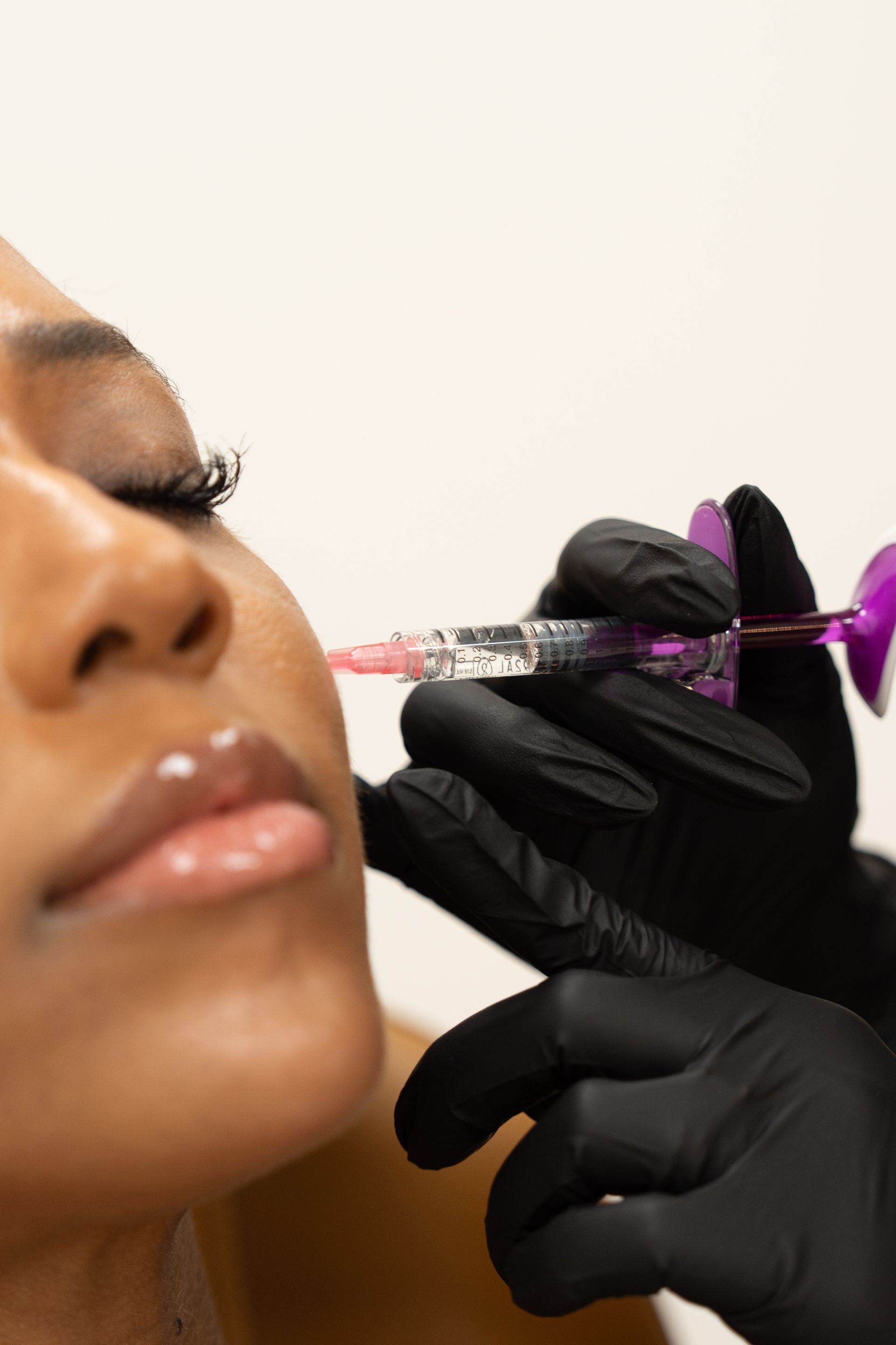 Gloved hands inject pink liquid into a person’s lips with a syringe.
