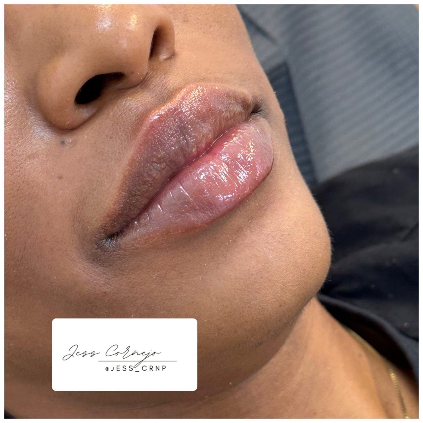 Close-up of glossy pink lips and nose, with a small logo watermark in the corner