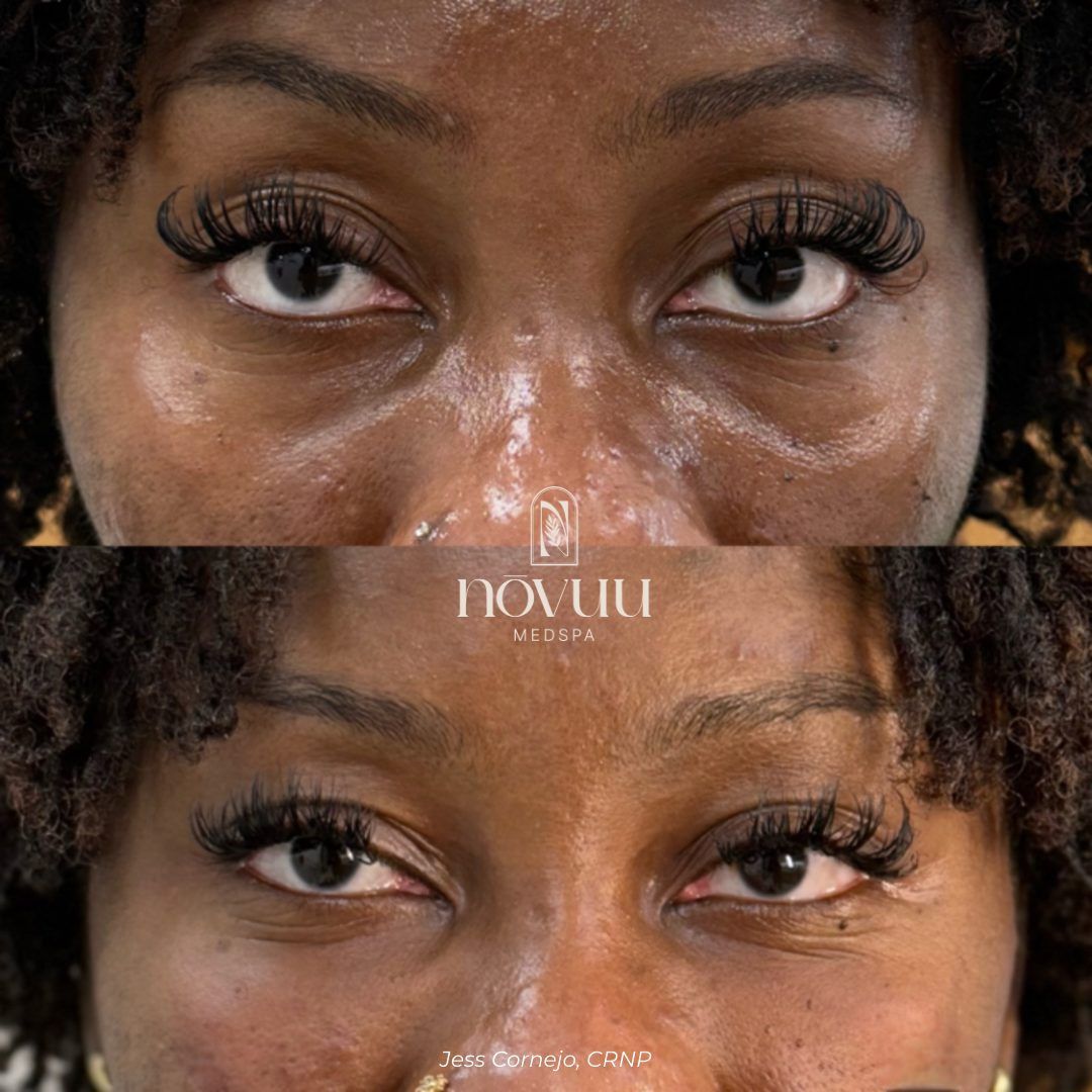 Close-up of eyes with long lashes, shown in a mirrored top-and-bottom layout