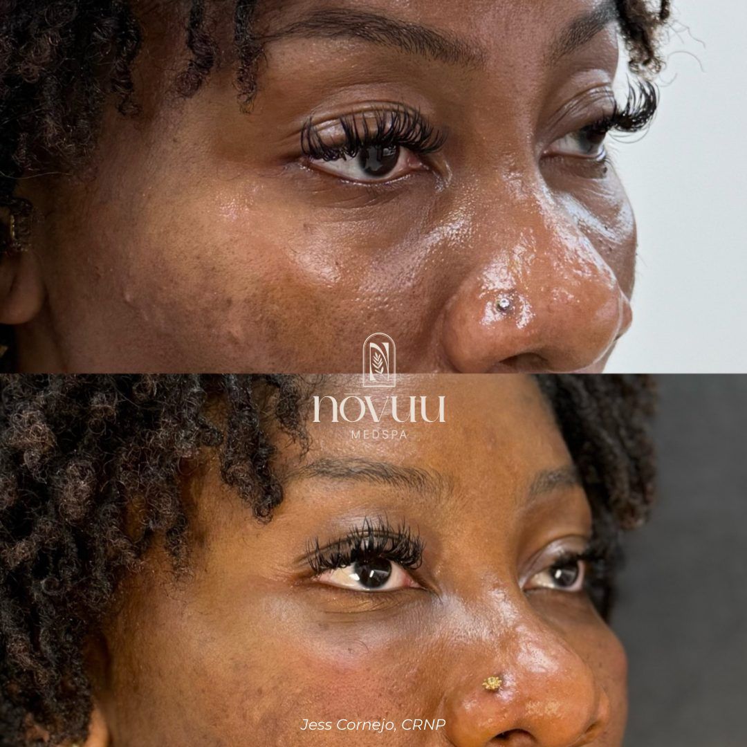 Close-up of a face with makeup and tears, shown in two overlapping views on a neutral background