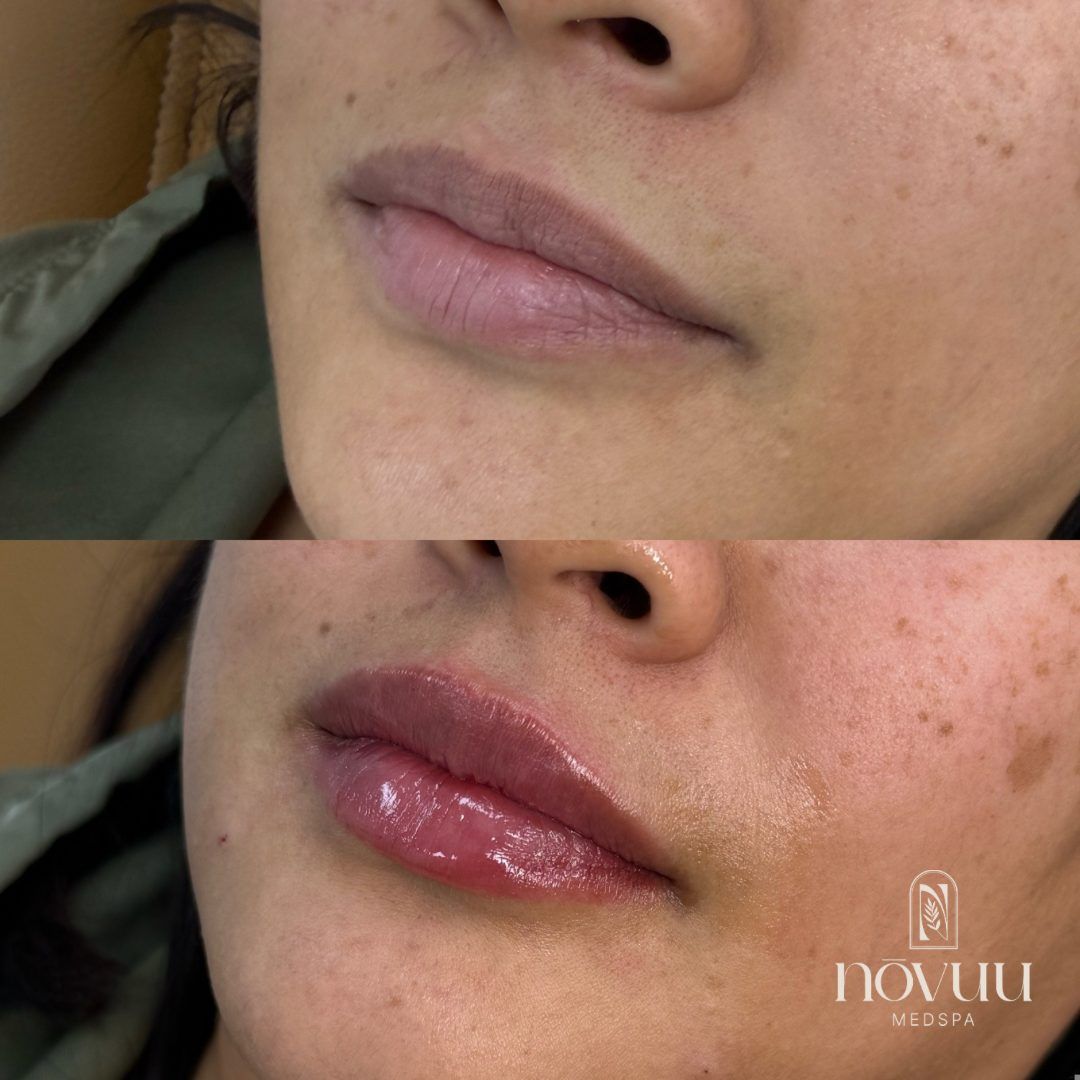Close-up of lips and lower face with visible dark spots and glossy lipstick, shown in two side-by-side views