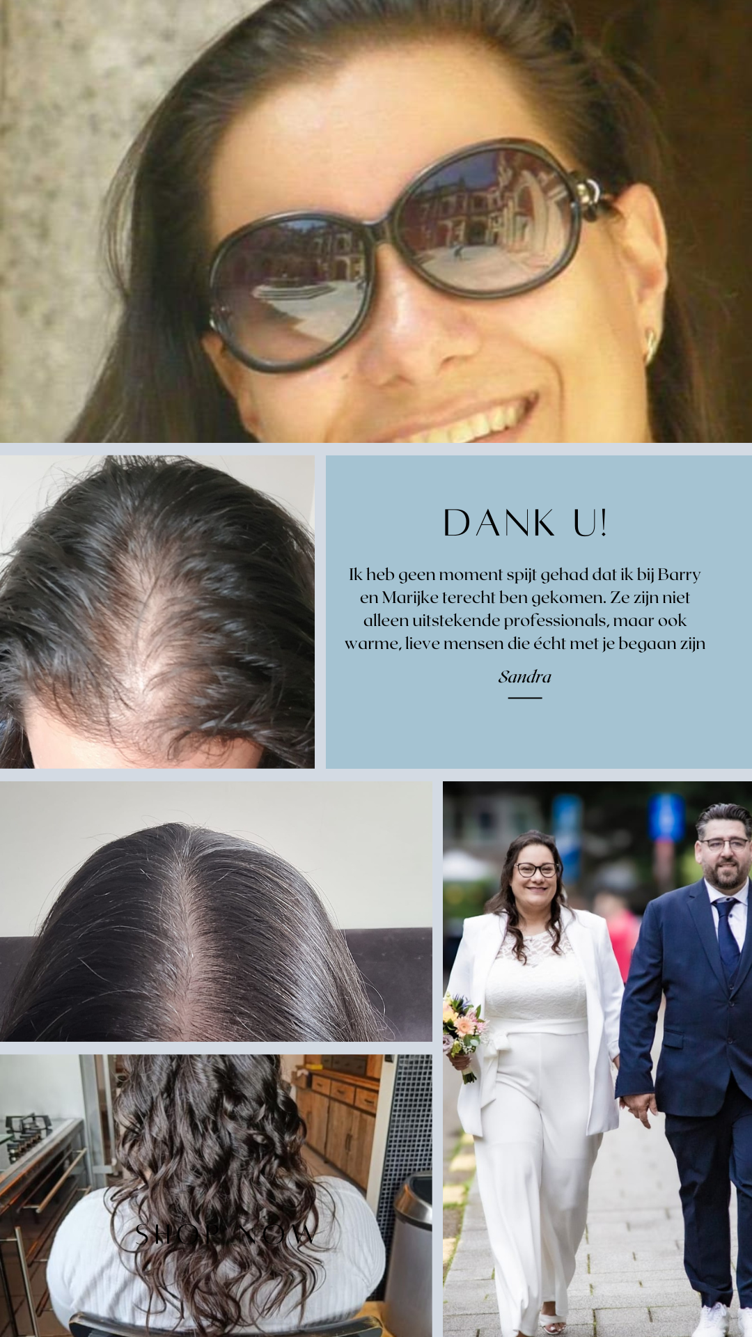 Sandra getuigt over haar transformatie  in de Haar en Huid Kliniek in Tessenderlo