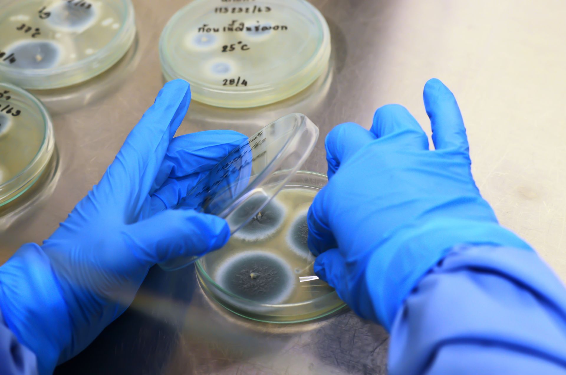 preparation for microscopic examination of fungal
