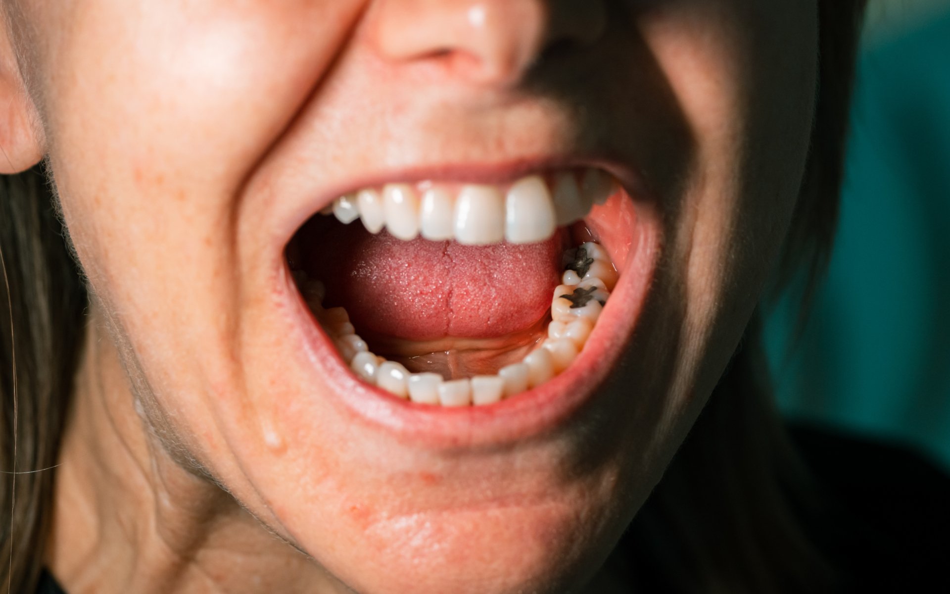 General Dentistry Services in Thornlands Tooth Fairy & Co