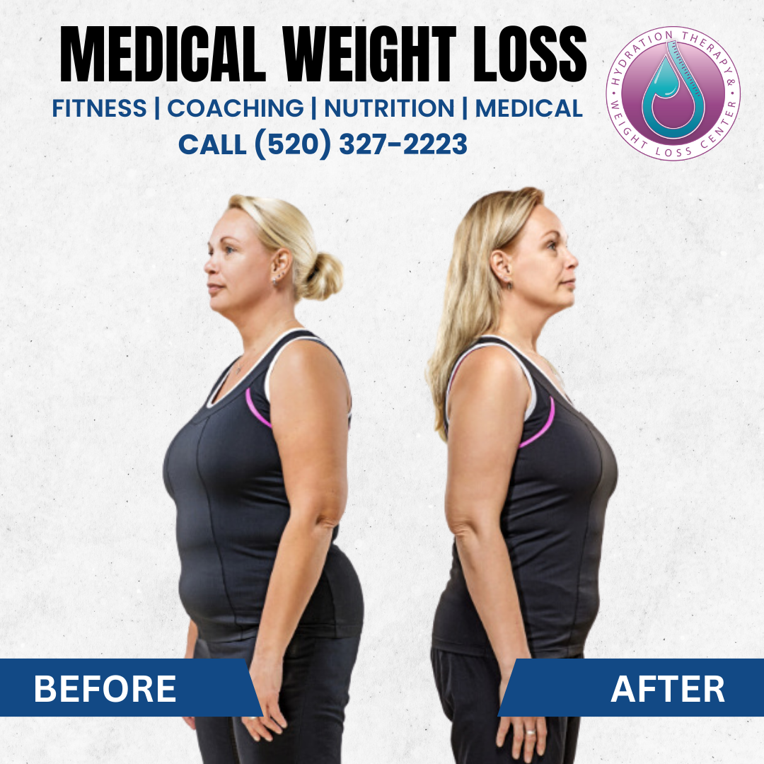 Side-by-side comparison: woman before and after weight loss, with 