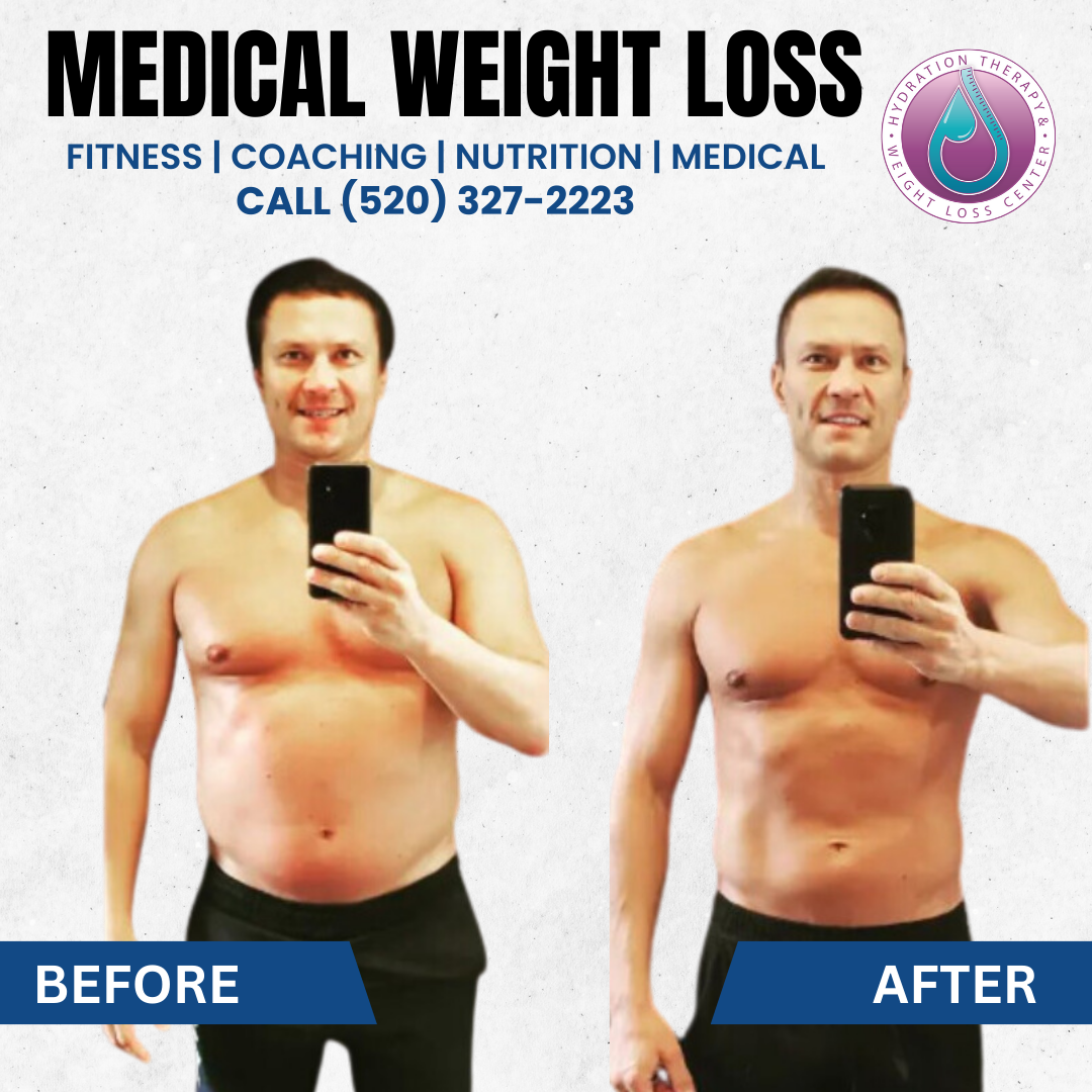 Before and after comparison of a man, promoting medical weight loss. Text includes services offered and phone number.