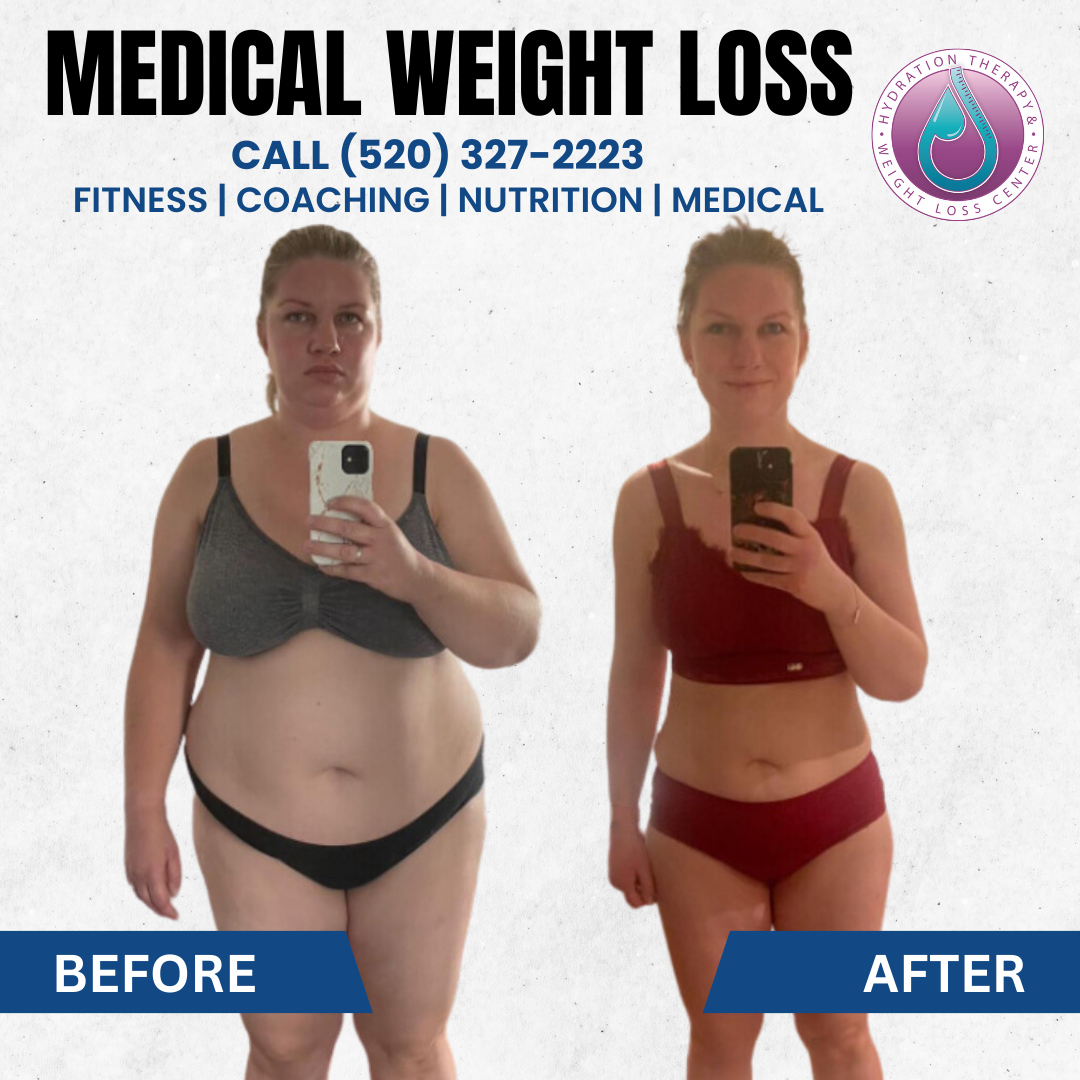 Weight loss advertisement: woman before and after, showing weight loss, text 