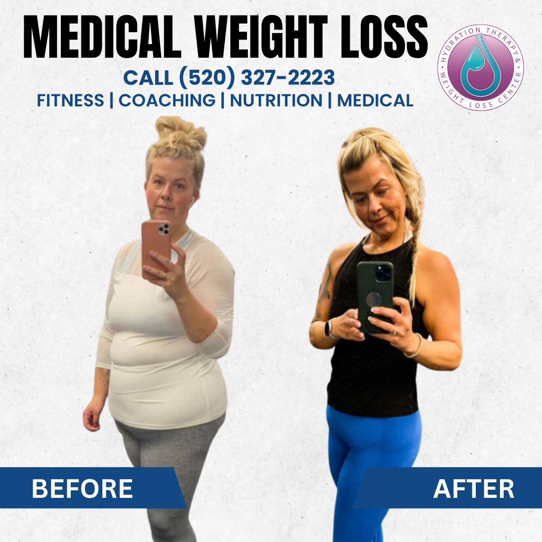 A woman before and after weight loss. 