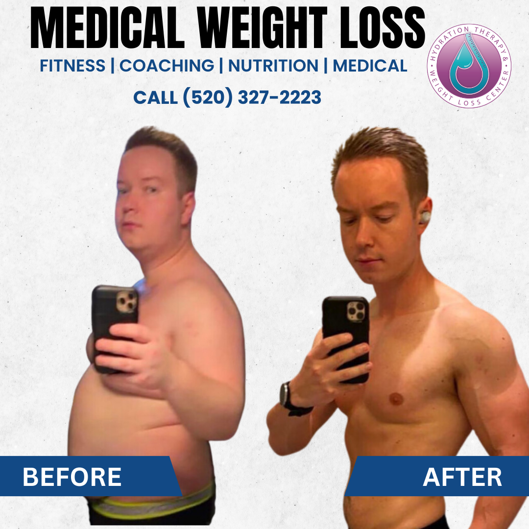 Before-and-after weight loss comparison.