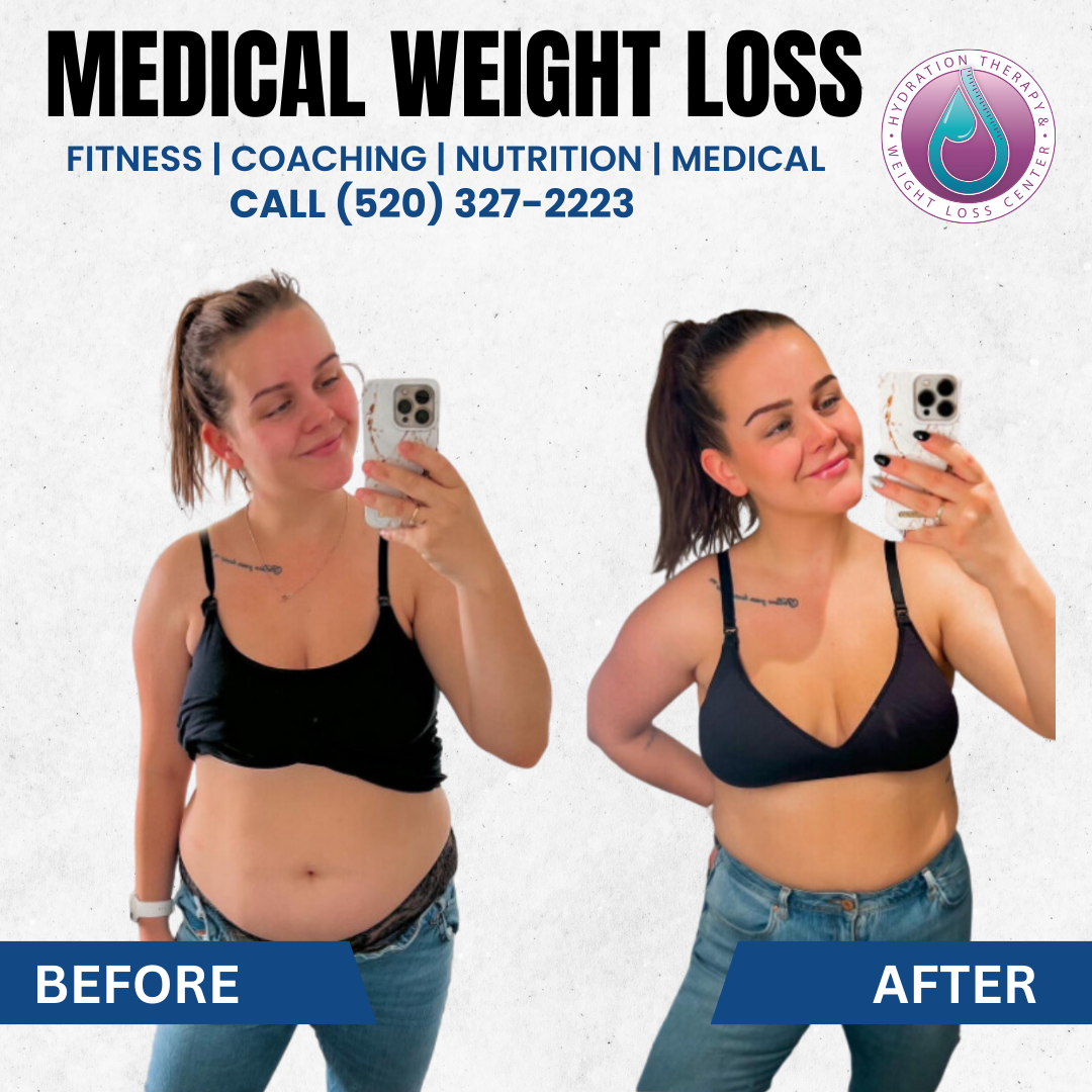 Side-by-side comparison: woman before and after weight loss, promoting medical weight loss services.